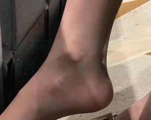 First Image